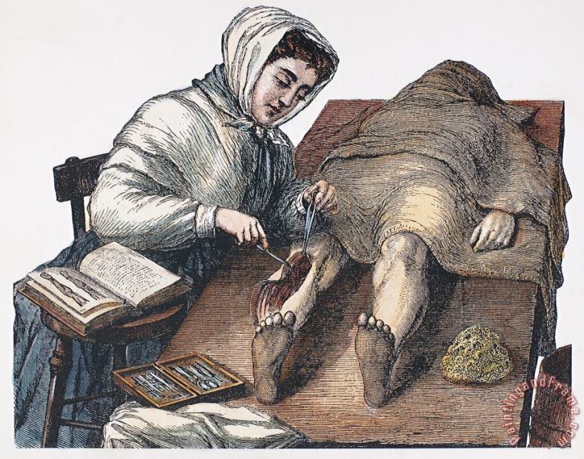 Others DISSECTION, 19th CENTURY Art Painting