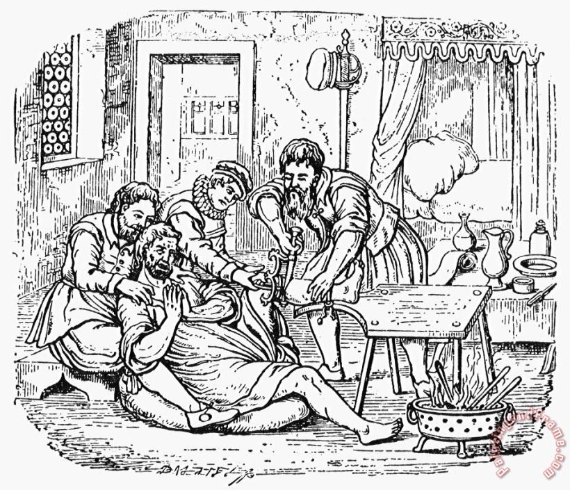 Home Amputation, 1592 painting - Others Home Amputation, 1592 Art Print